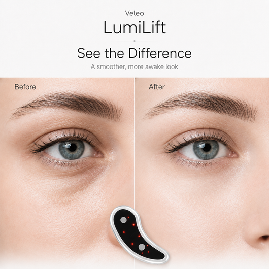 Nevaro LumiLift™ EMS Eye Patches