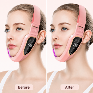 Nevaro JawLift™